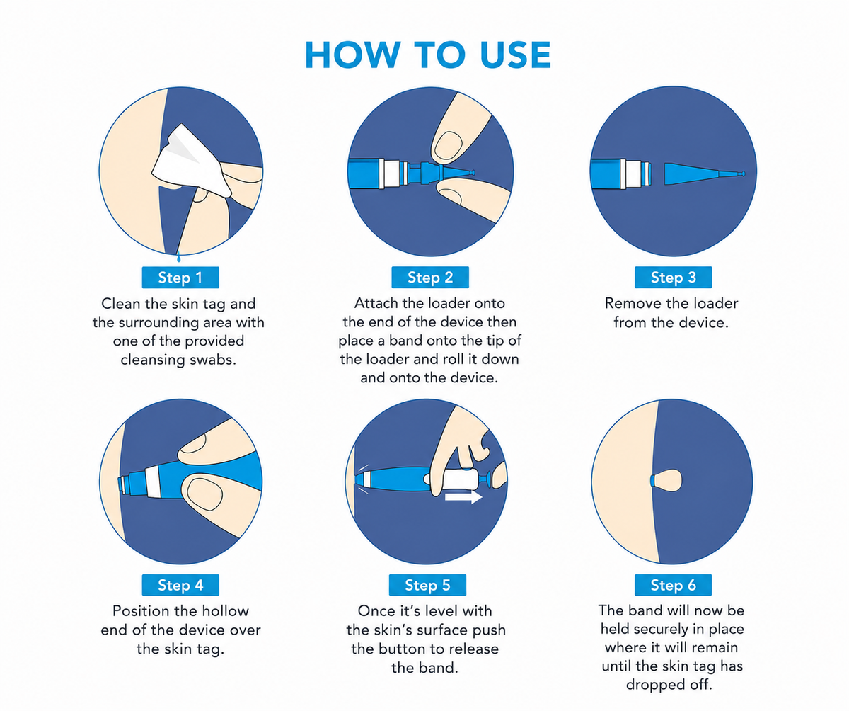 7- Day Skin Tag Clear